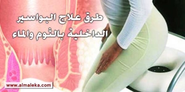 طرق سريعة لعلاج البواسير الداخلية بالثوم والماء