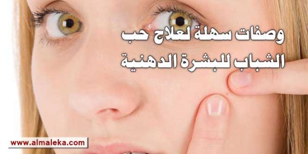 وصفات سهلة لإزالة وعلاج حب الشباب للبشرة الدهنية