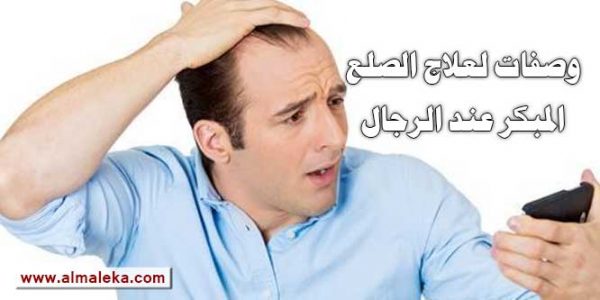 وصفات لعلاج الصلع المبكر عند الرجال