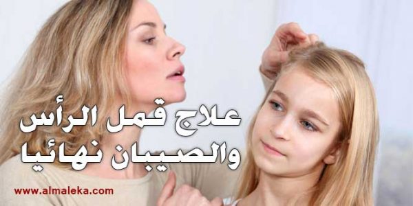 علاج قمل الرأس والصيبان نهائيا
