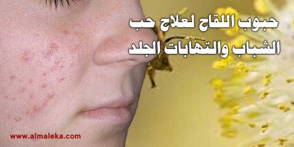حبوب اللقاح لعلاج حب الشباب والتهابات الجلد