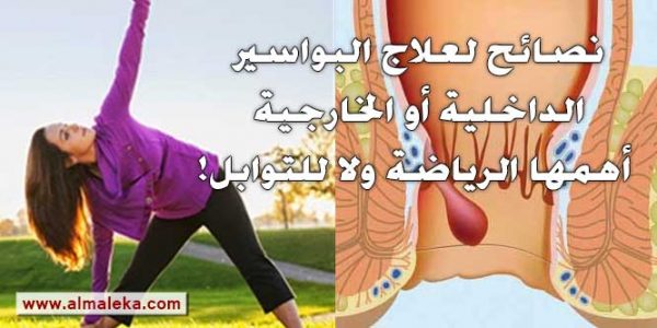 نصائح لعلاج البواسير الداخلية أو الخارجية أهمها الرياضة ولا للتوابل!