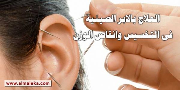 العلاج بالابر الصينية فى التخسيس وانقاص الوزن