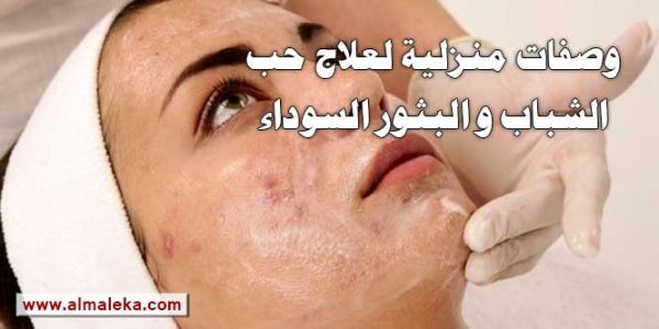 وصفات منزلية لعلاج حب الشباب والبثور السوداء