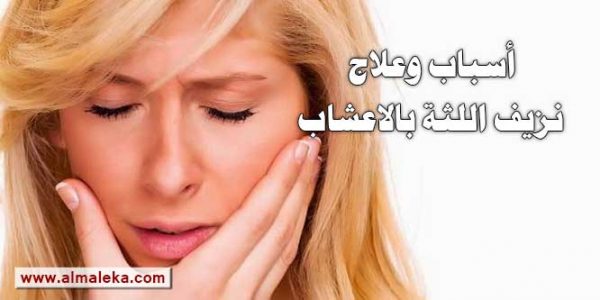 اسباب وعلاج نزيف اللثة بالاعشاب