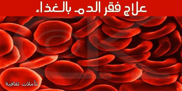 علاج فقر الدم الحاد بالغذاء