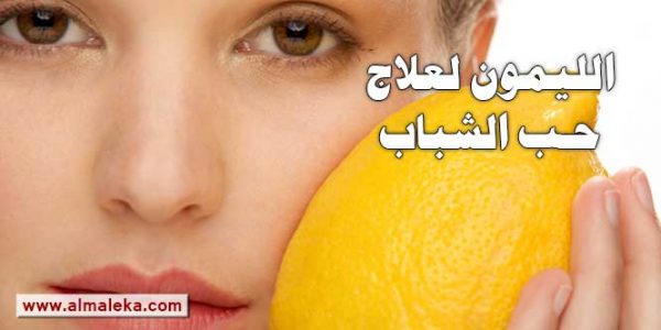 علاج حب الشباب بالليمون